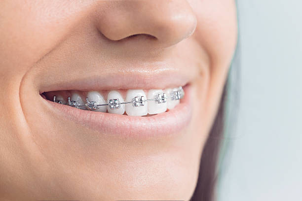 Best Tooth Extraction  in Salisbury, MD